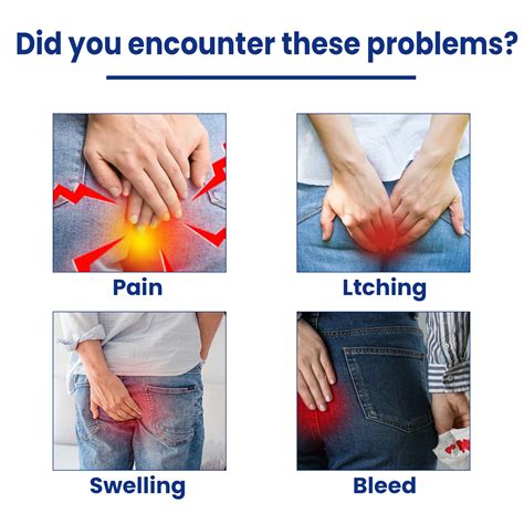 Ouhoe Hemorrhoids Ointment Relieve Pain Hemoroid Cream Anal Bleeding Swelling Anal Fissure