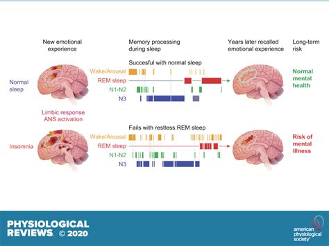 Brain Mechanisms Of Insomnia: New Perspectives On Causes, 52% OFF