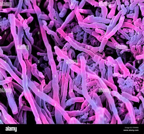 Streptomyces Coelicoflavus Bacterias Color An Lisis Micrograf A De