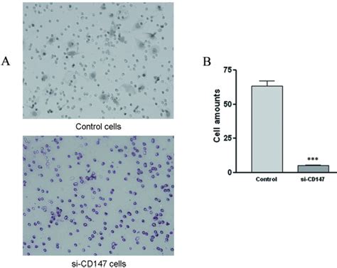 Effects Of Si CD147 RNA On SMMC 7721 Cells Invasive Abilities The