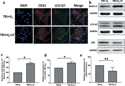 Effects Of Pi3 K Inhibitor Ly294002 On Expressions Of Three