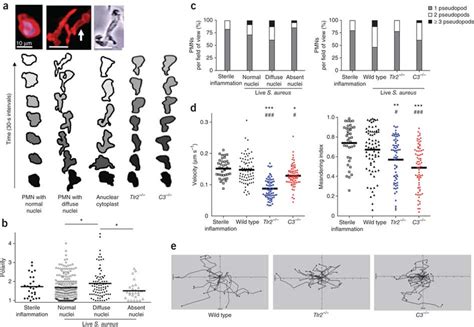 NET-forming PMNs show a unique crawling phenotype in vivo related to... | Download Scientific ...