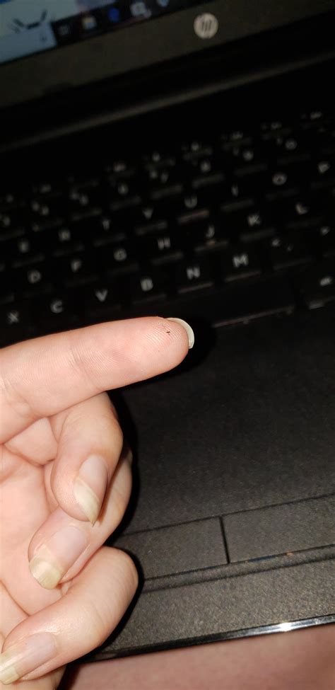 There are these super tiny bugs in my bedroom. They dont bite and they