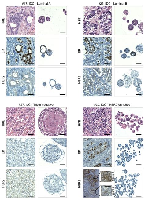 Organoids Recapitulate The Histological Features Of Primary Bcs