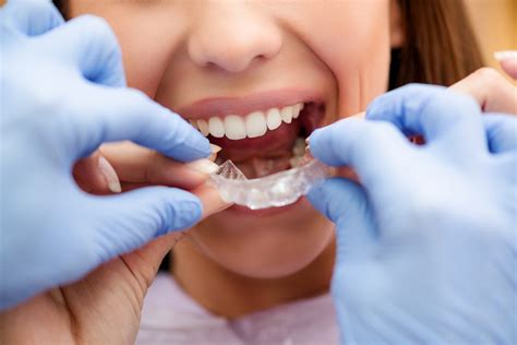 Invisalign Tips Every Orthodontic Patient Should Know