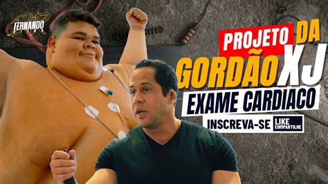 PROJETO GORDÃO DA XJ DR FERNANDO VITOR ALEXANDRE E REGES YouTube