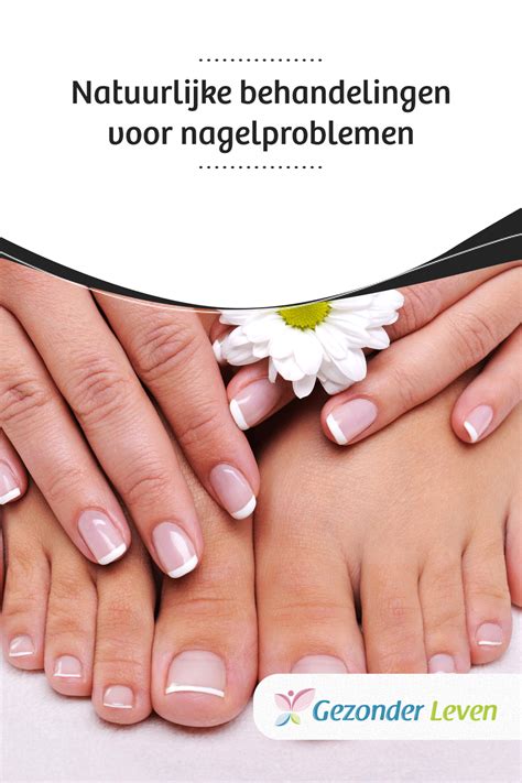 Natuurlijke Behandelingen Voor Nagelproblemen Natuurlijke