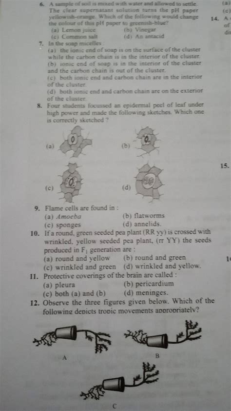 Flame cells are found in : | Filo