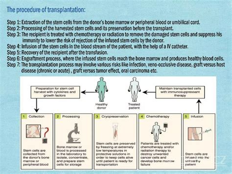 Hematopoietic Stem Cells Transplantation Ppt