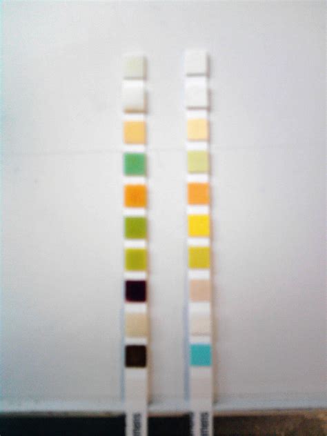 File:Comp.Urine.Test.Strip.jpg - Wikimedia Commons