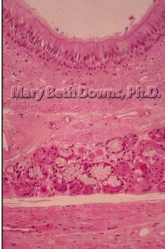 Path Histology Of Epithelial Tissues Flashcards Quizlet