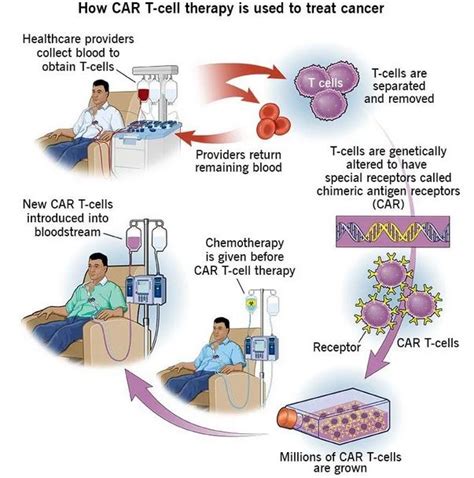 Car T Cell Therapy Approved For Cancer Civilsdaily