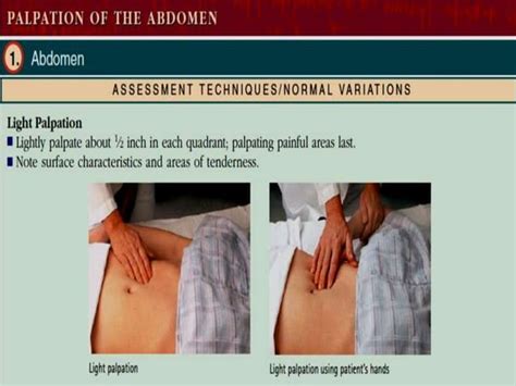 Abdominal Assessment Ppt