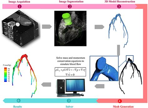 Frontiers Application Of Patient Specific Computational Fluid