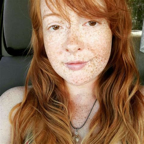 Pin On Freckles