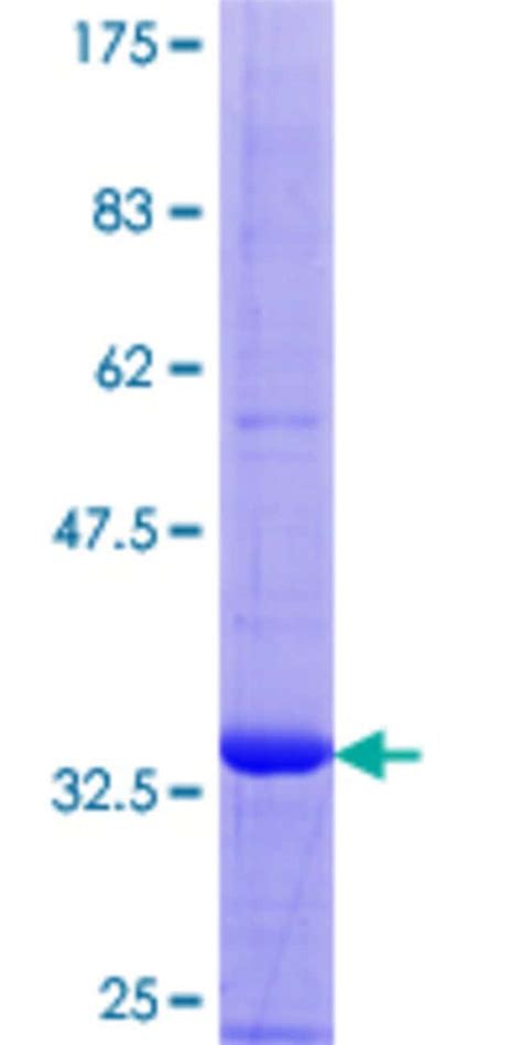 Abnova Human SCGB2A1 Full Length ORF NP 002398 1 1 A A 95 A A