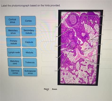 Solved Label The Photomicrograph Based On The Hints Chegg