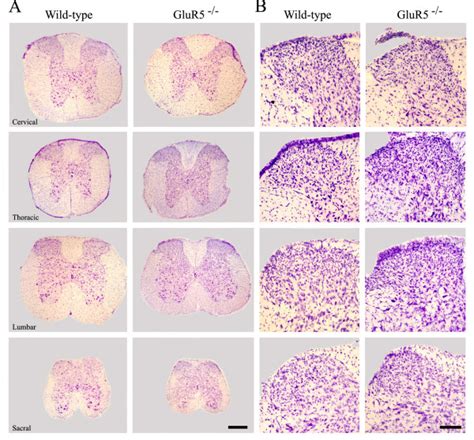 Morphology Of The Spinal Cord In Wild Type And Glur5 Mice A Download Scientific Diagram