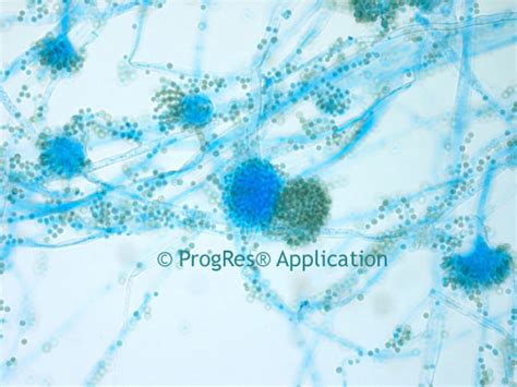 Microscope World Blog: Aspergillus (Mold!) under the Microscope