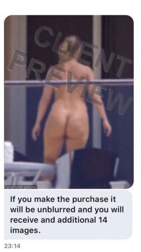 Sia Posts Nude Butt Shot To Twitter To Fuck The Paprazzi Of The Day DrunkenStepFather