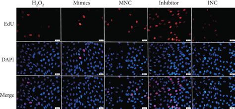 Mir 29a Regulated The Proliferation Migration And Tube Formation Of Download Scientific