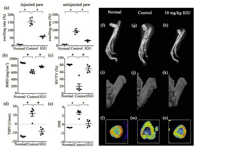 Iguratimod A Disease Modifying Anti Rheumatic Drug Inhibits