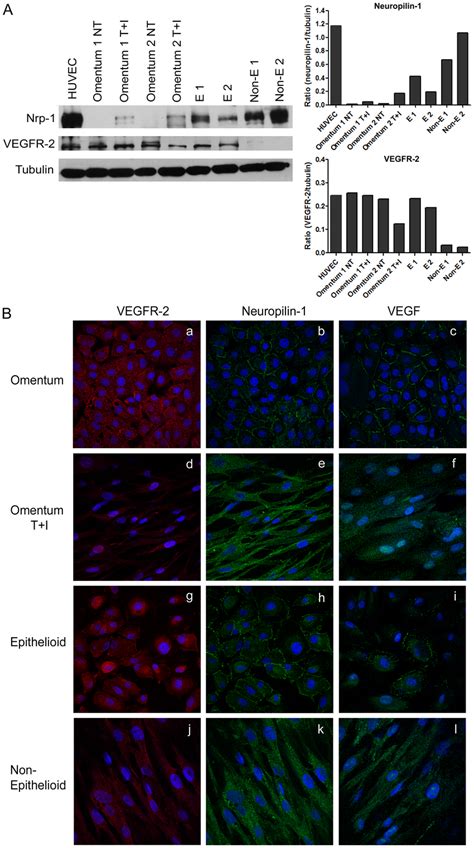 Expression Levels And Cellular Distribution Of Nrp 1 And Vegfr2