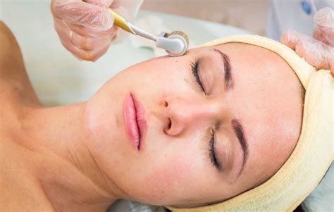 Microneedling Wirkung Funktion Produktempfehlungen