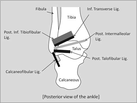 Posterior Ankle Impingement In Athletes Pathogenesis Imaging Features