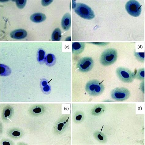 Erythrocyte Cells With The Presence Of Mn And Na A Micronucleus B