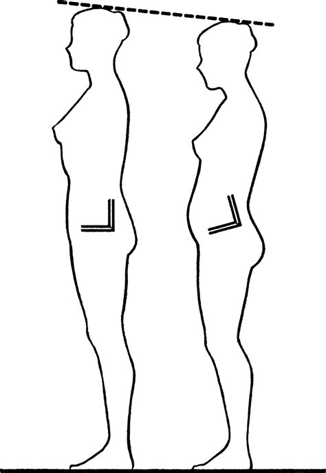 Pelvic tilt - Wikipedia