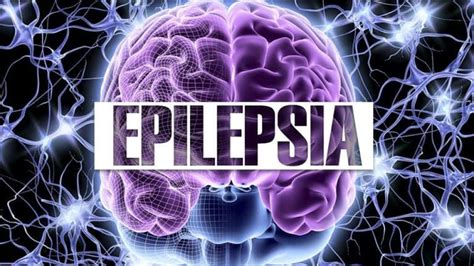 Epilepsia Qué Es Causas Síntomas Y Tratamiento Con Imágenes Epilepsia Sintomas De Epilepsia