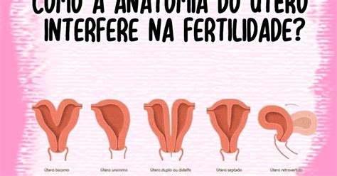 O útero é Um Dos órgãos Principais Do Sistema Reprodutor Feminino E