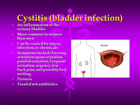 What Antibiotic Treat Bladder Infection