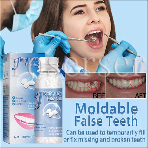 30ml Temporary Tooth Repair Kit Filling Teeth Gaps Moldable False Teeth