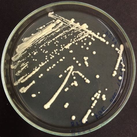 plate preparation
