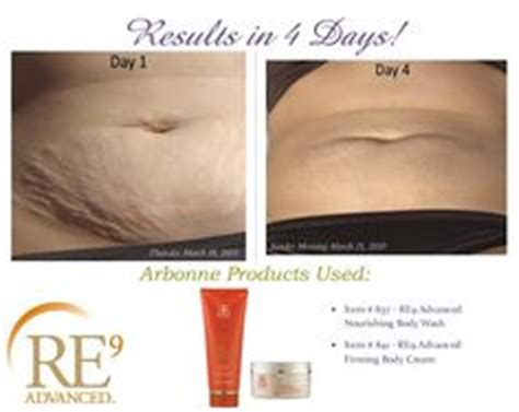 30 Before and After ARBONNE photos ideas | arbonne, skin care, skin