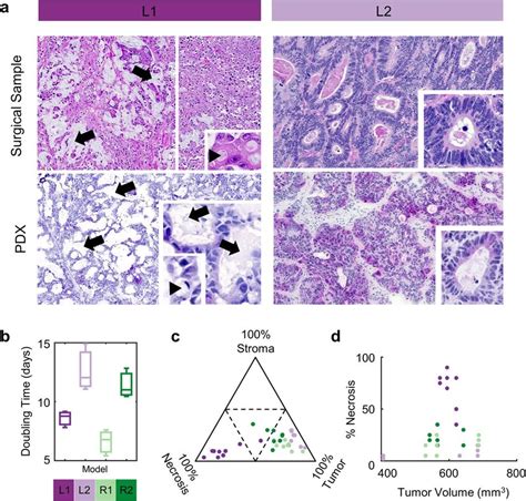 Growth And Histological Profiling Of The PDX Model A Histopathologic