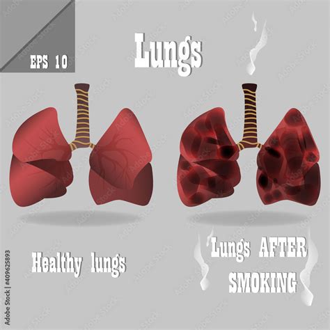 Vector medical educational illustration of lungs anatomy. Healthy lungs ...