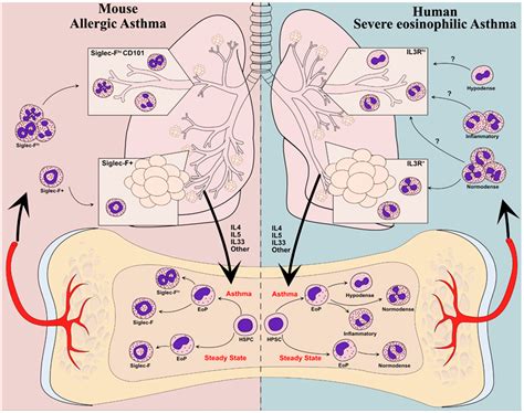 Asthma Peripheral Neuropathy Eos Level Shooting Pain Online Smarys Org