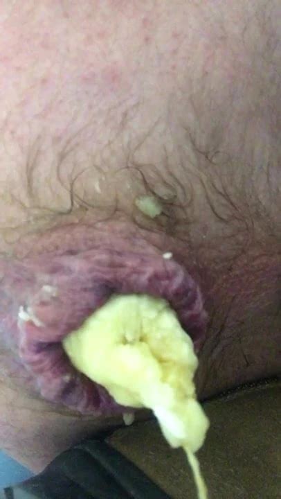 Banane Dans Le Cul French Gay Amateur Amateur Porn XHamster