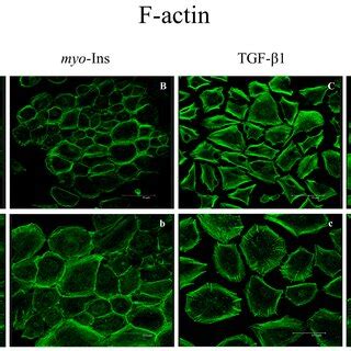 Tgf Triggers Morphological Changes In Mcf A Cells After Five Days