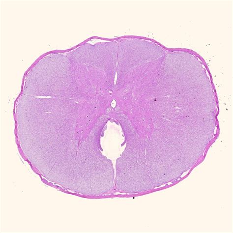 Human spinal cord cross-section histology slides, 7 µm sec., H&E Stain ...