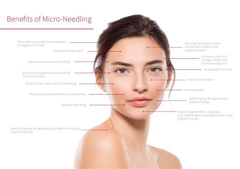 Micro Needling – Charlene Hogan Skin