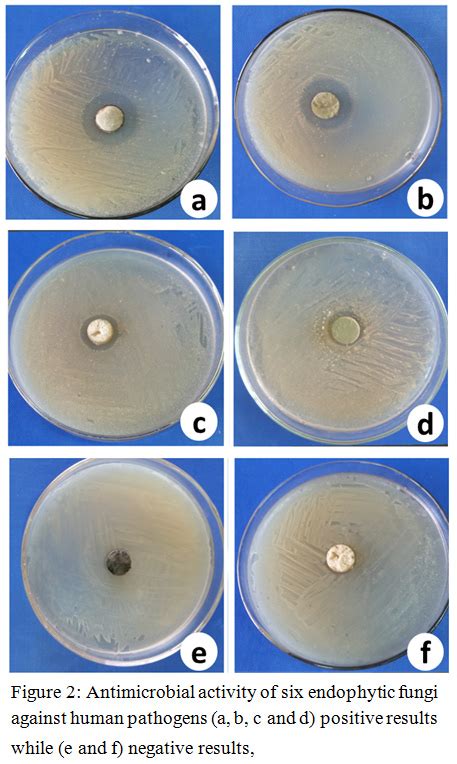 Molecular Identification Extracellular Enzyme Production And