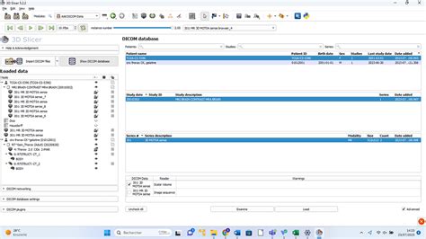 Dice Dicoms Image Support 3d Slicer Community