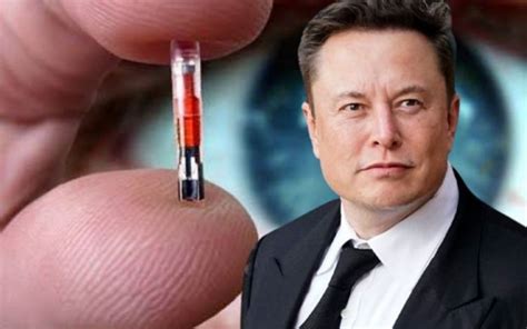 Elon Musk Anuncia Primeiro Implante De Chip Cerebral Da Neuralink Em