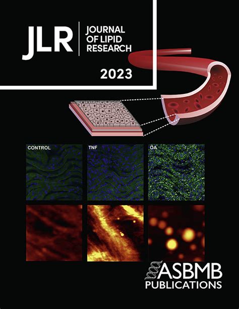 Home Page Journal Of Lipid Research