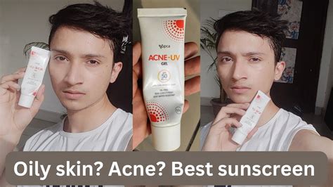 Acne Uv Gel Sunscreen Review Sunscreen For Acne Prone Skin Detailed Review Sunscreen Youtube