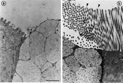 Electron Micrograph Of Rabbit Appendix And Peyers Patch Goblet Cells